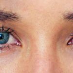 Ojos2